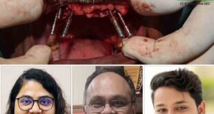 टीएमयू के डेंटल कॉलेज का वृद्ध को तोहफा, फिर से मिली बत्तीसी