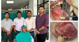 टीएमयू हॉस्पिटल के डेंटल डॉक्टर्स की टीम ने बिजनौर के किशोर की लौटाई मुस्कान